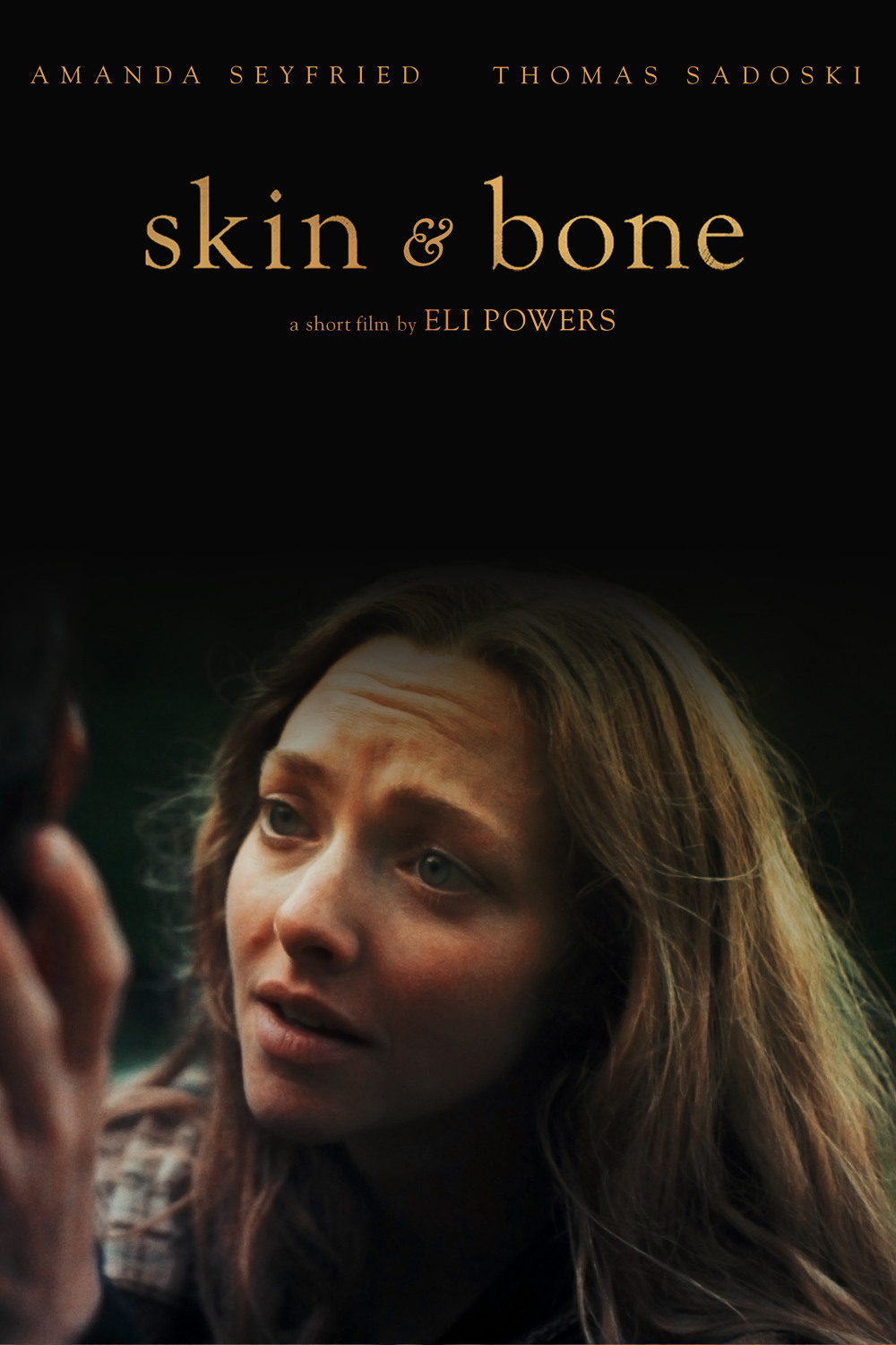 SKIN & BONE
